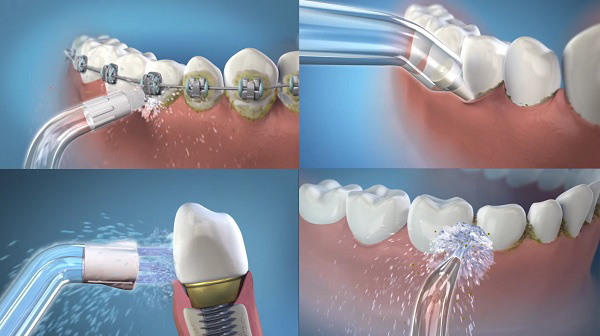 Lợi ích máy tăm nước là gì