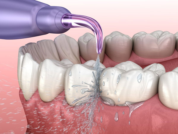 Công dụng máy tăm nước