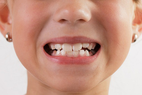 tác hại nghiến răng khi ngủ