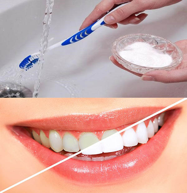 làm sạch cao răng tại nhà