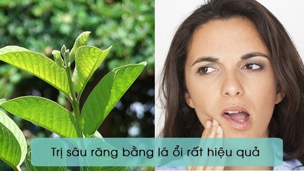 Cách chữa sâu răng tại nhà bằng lá ổi