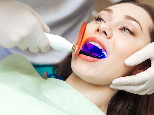 làm trắng răng có hại không