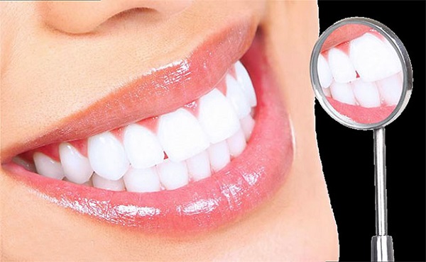 tác hại của tẩy trắng răng