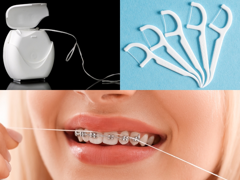 Các loại chỉ nha khoa thích hợp cho vệ sinh răng miệng