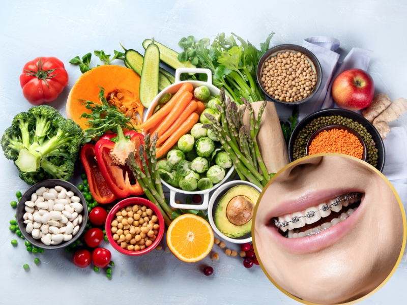 Các loại thực phẩm bạn nên ăn khi niềng răng