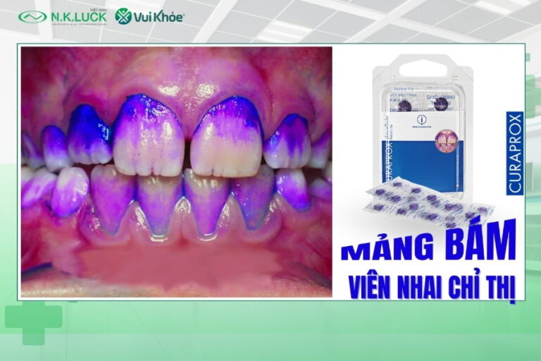 Viên nhai chỉ thị mảng bám (Thumbnail)