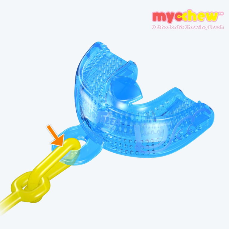 MyoChew: Khí cụ tập nhai chỉnh nha cho trẻ từ 2-8 tuổi màu xanh dương