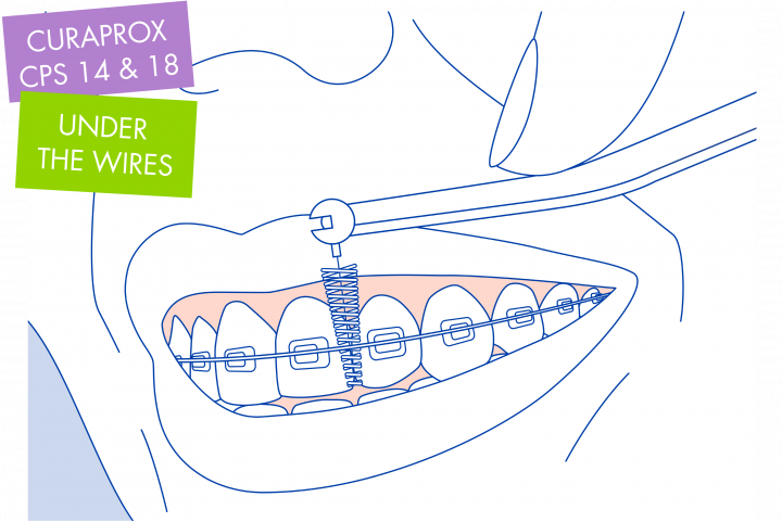 Ortho Technical Illustration-upravene-720x481