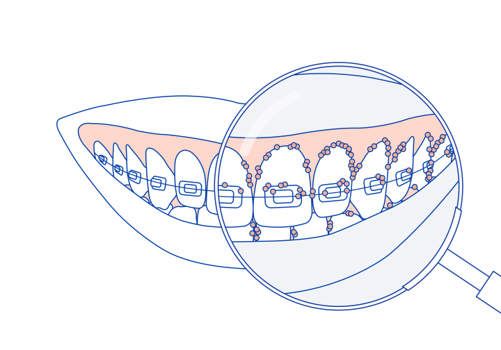 Ortho Technical Illustrations final Ortho Technical Illustration -17-720x504 (1)
