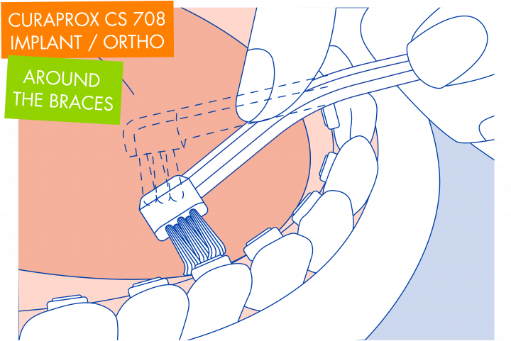 article-illustrations-05-720x481