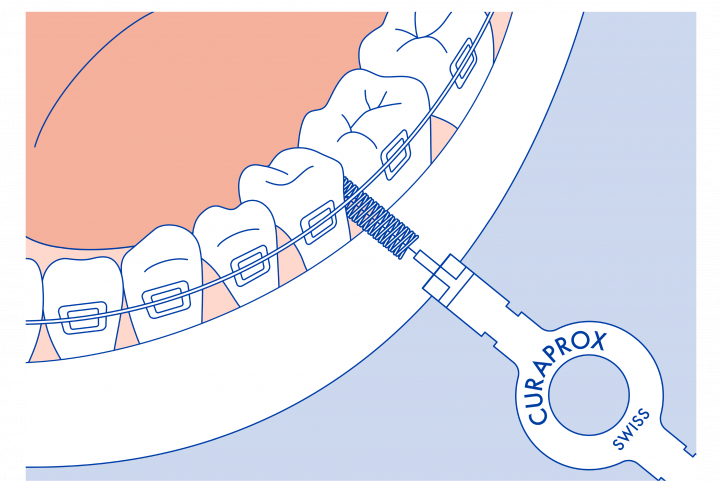 Tìm góc để đặt bàn chải kẽ răng