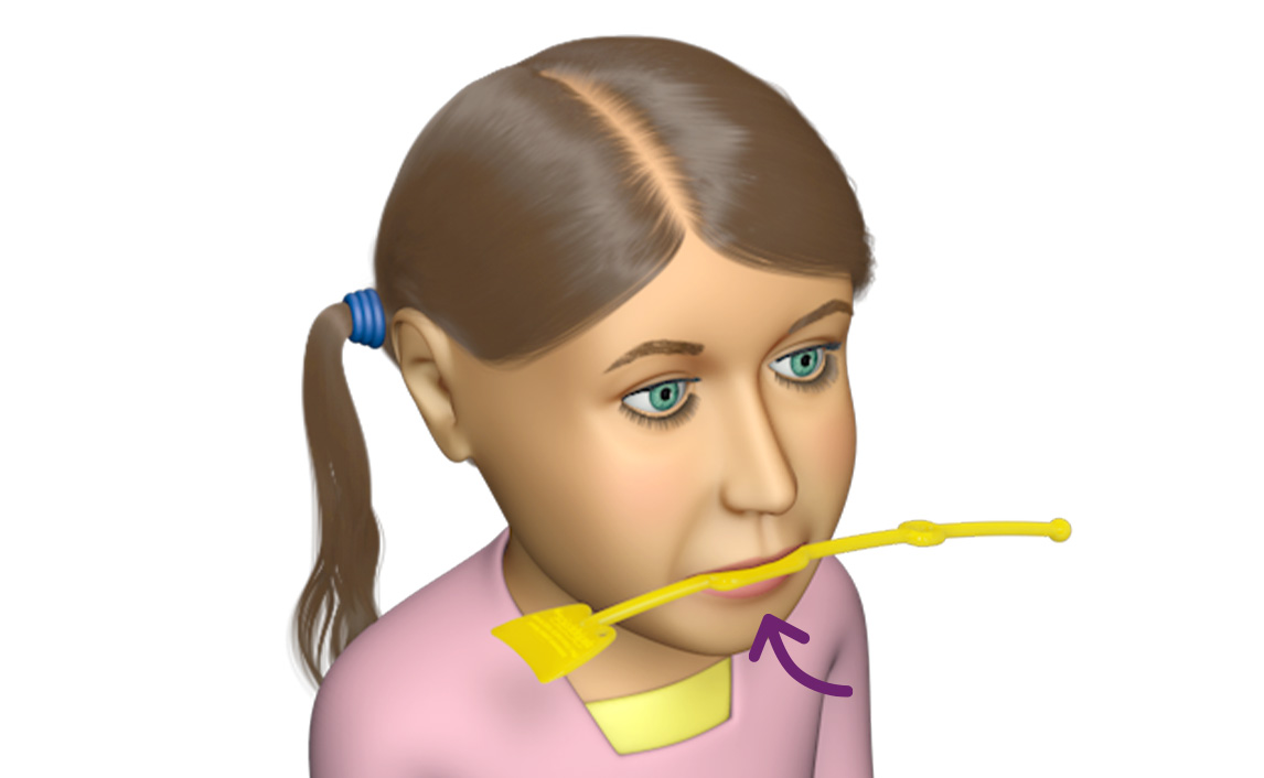 Bộ Lip Trainer&trade; – LT v&agrave; Lip Seal Trainer – LST